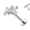 Labret Cartilage with Elongated and Round Crystals